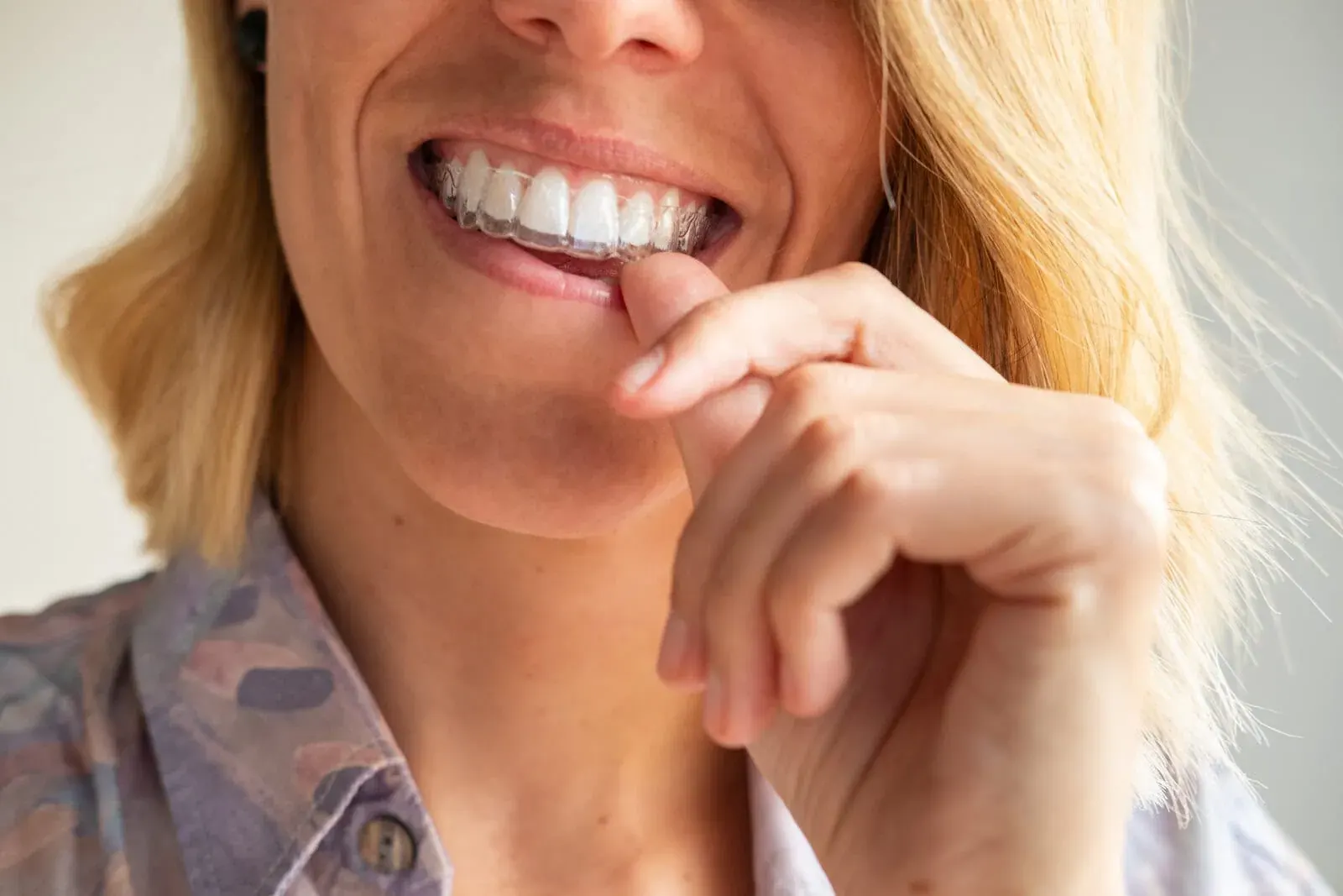 Orthodontics & Alignment