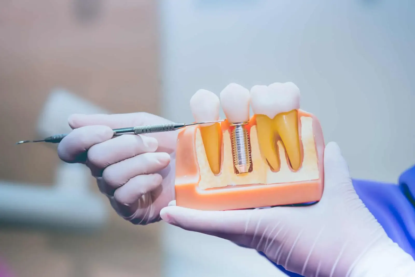 Dental implants at our Newkirk office